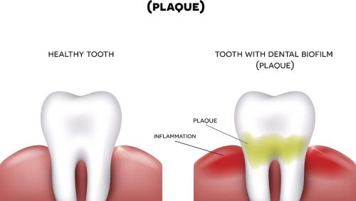牙科材料如何申请俄罗斯医疗器械注册证